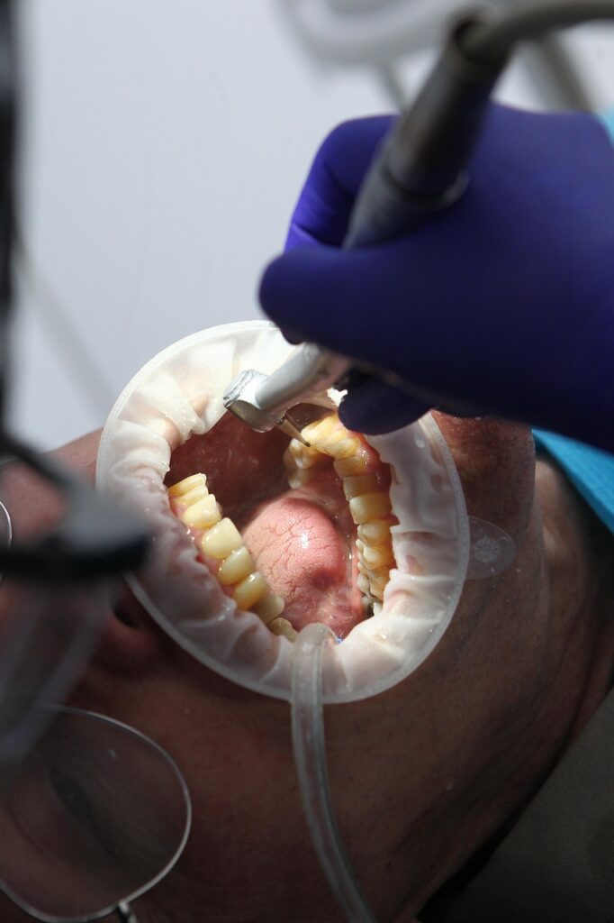 LEDホワイトニングのケア用品はどれを選ぶべき？