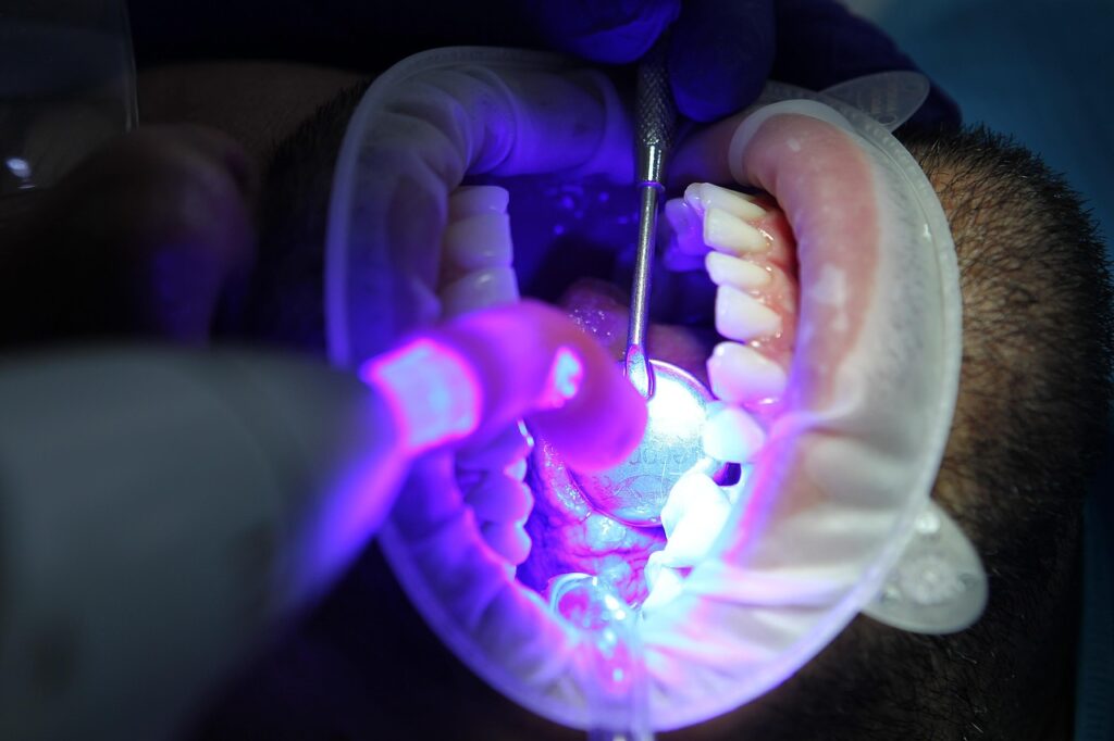 LEDホワイトニングはどれを選ぶ？比較して決める方法とは？